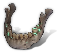 Radium Jawbone